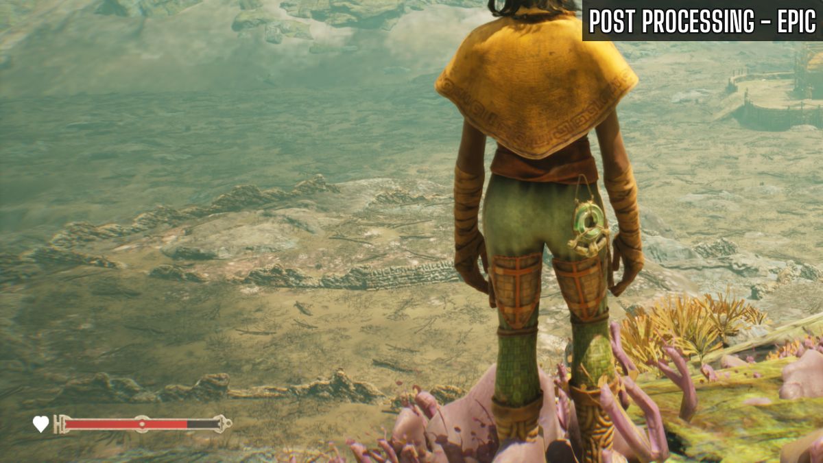 معالجة ما بعد ملحمة